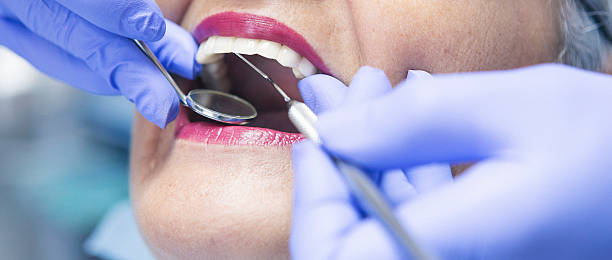 Best Dental Abscess Treatment in Algood, TN