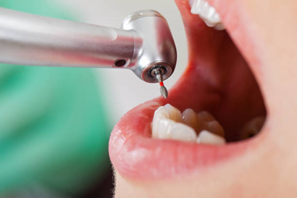 Best Broken or Chipped Tooth Repair in Algood, TN